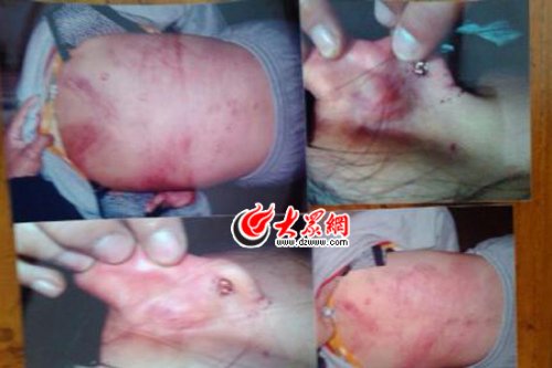 　山東藝術(shù)設(shè)計(jì)學(xué)院16歲女生宿舍內(nèi)被女同學(xué)暴打4小時(shí)。