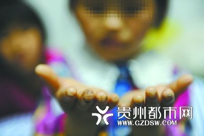 指尖被針扎得傷痕累累。