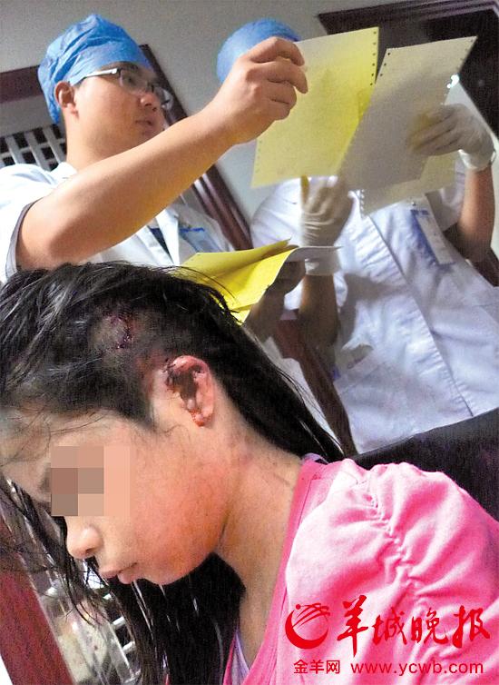 受傷的11歲女孩頭發(fā)被卷入扶梯，耳朵被嚴重拉傷，需手術。