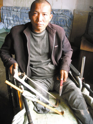 鄭艷良就是用這幾樣簡陋工具，給自己做了右腿截肢手術(shù)。