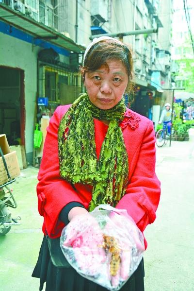 頭部受傷的黃女士展示兩根大魚(yú)刺。