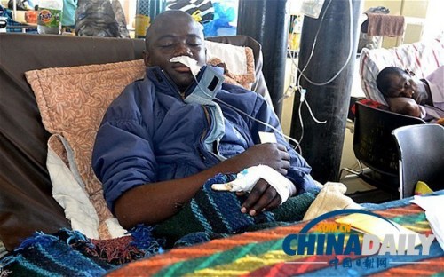 雖然已經(jīng)在醫(yī)院接受了近一個月的恢復(fù)治療，卡托卡的身體仍然非常虛弱。