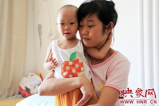 孩子和媽媽在一起，她的右眼已經(jīng)失明。