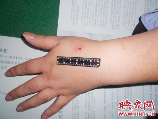 為幫助無證駕駛的朋友逃避處罰，新鄉(xiāng)的王某竟對執(zhí)勤民警大打出手，還將一名民警的手臂咬傷