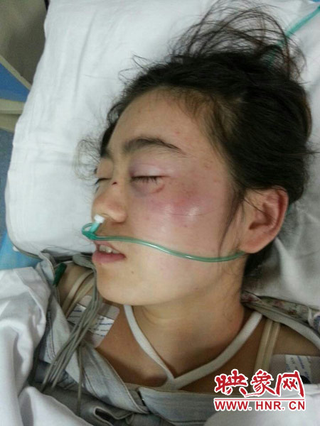 9月10日晚,被暴打的小陳出現(xiàn)了間歇性昏迷,被送進(jìn)了省人民醫(yī)院。