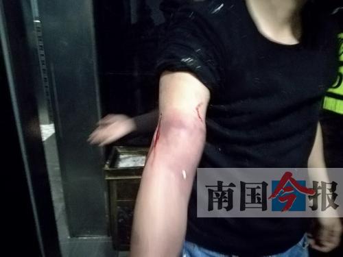 覃先生手臂被卡的部位受傷流血，所幸傷勢無大礙。 通訊員 王建民 攝