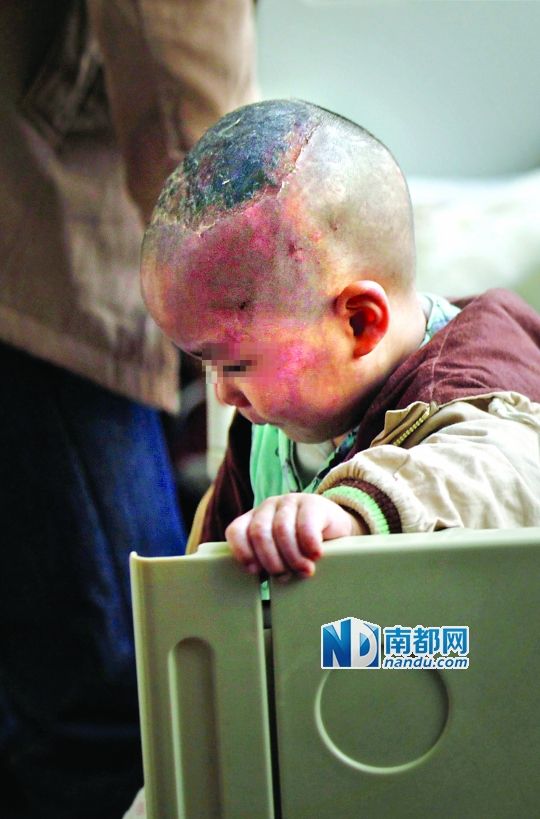1月8日下午，小寶頭上和臉上都是傷痕。