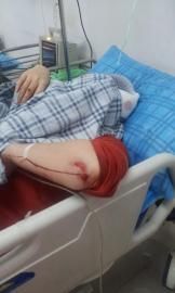 砸窗當事人胡女士在醫(yī)院接受治療。
