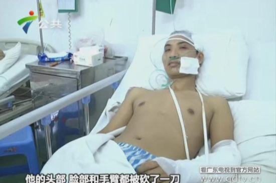 另一名傷者頭部、臉部和手臂都被砍了一刀。(視頻截圖)