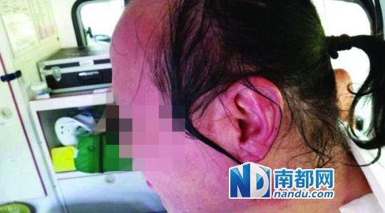 涉事教師遭熱水潑臉后的照片。