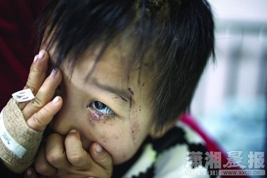 1月13日，湖南省兒童醫(yī)院，4歲的源源用手蒙住了眼睛。
