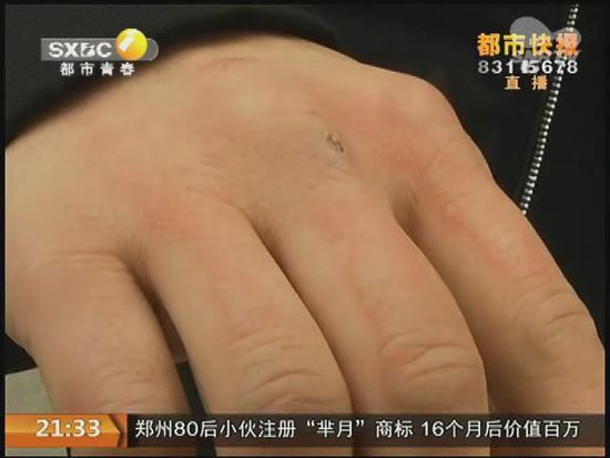 說到這足療拔罐，估計大伙都不陌生，但是想起4號晚上的拔罐的經(jīng)歷，呂先生現(xiàn)在想起來，還心有余悸。
