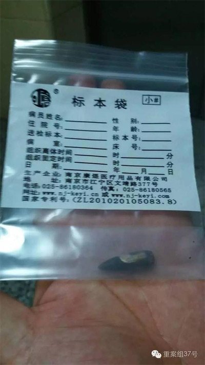 經(jīng)警方鑒定，秦女士體內(nèi)取出的子彈系56式步槍射出 。 受訪者供圖