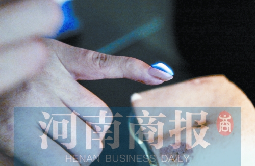 將指甲油涂在指甲上，靠近火焰時被引燃了